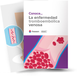 Conoce... La enfermedad tromboencefálica venosa